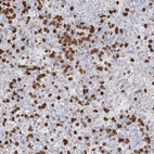 Anti-ZNF227 Antibody