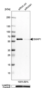 Western blot analysis in Rh30 cells transfected with control siRNA, target specific siRNA probe #1, using Anti-SMAP1 antibody. Remaining relative intensity is presented. Loading control: Anti-GAPDH.