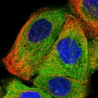 Immunofluorescent staining of human cell line A-431 shows positivity in plasma membrane & cytoplasm.