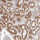 Anti-IL22RA2 Antibody