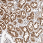 Anti-IL22RA2 Antibody
