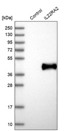 Western blot analysis in control (vector only transfected HEK293T lysate) and IL22RA2 over-expression lysate (Co-expressed with a C-terminal myc-DDK tag (~3.1 kDa) in mammalian HEK293T cells, LY403617).