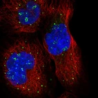 Immunofluorescent staining of human cell line A-431 shows localization to nucleoli fibrillar center & vesicles.