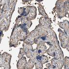 Anti-PRSS23 Antibody