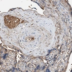 Immunohistochemical staining of human placenta shows moderate positivity in plasma.