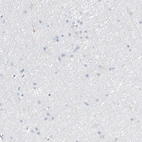 Immunohistochemical staining of human cerebral cortex shows no positivity in neuronal cells as expected.