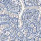 Immunohistochemical staining of human duodenum shows low expression in glandular cells as expected.