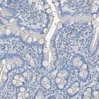 Immunohistochemical staining of human duodenum shows low expression in glandular cells as expected.