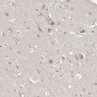 Anti-CARMIL3 Antibody