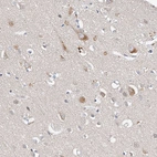 Anti-CARMIL3 Antibody