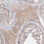 Immunohistochemical staining of human testis shows moderate cytoplasmic positivity in Leydig cells.