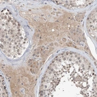 Immunohistochemical staining of human testis shows moderate cytoplasmic positivity in Leydig cells.