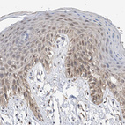 Immunohistochemical staining of human skin shows weak cytoplasmic positivity in squamous epithelial cells.