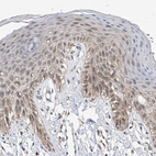 Anti-CARMIL3 Antibody