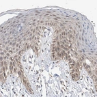 Immunohistochemical staining of human skin shows weak cytoplasmic positivity in squamous epithelial cells.