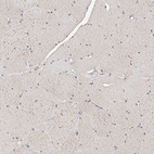 Immunohistochemical staining of human skeletal muscle shows low positivity in myocytes as expected.