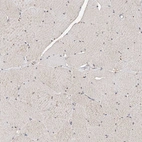 Immunohistochemical staining of human skeletal muscle shows low positivity in myocytes as expected.