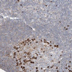 Anti-ZFP30 Antibody