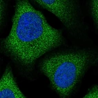 Immunofluorescent staining of human cell line U-2 OS shows localization to cytosol.