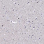 Immunohistochemical staining of human cerebral cortex shows low expression as expected.