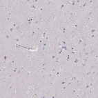 Immunohistochemical staining of human cerebral cortex shows low expression as expected.