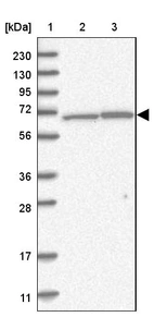 Lane 1: Marker [kDa] 230, 130, 95, 72, 56, 36, 28, 17, 11_br/_Lane 2: Human cell line RT-4_br/_Lane 3: Human cell line U-251MG sp