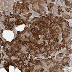 Anti-TMEM61 Antibody