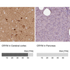 Anti-CRYM Antibody