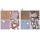 Immunohistochemical staining of human cerebral cortex, kidney, pancreas and prostate using Anti-CRYM antibody HPA030619 (A) shows similar protein distribution across tissues to independent antibody HPA019086 (B).