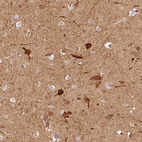Immunohistochemical staining of human cerebral cortex shows moderate to strong cytoplasmic positivity in neurons.