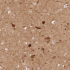 Immunohistochemical staining of human cerebral cortex shows moderate to strong cytoplasmic positivity in neurons.
