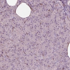 Immunohistochemical staining of human pancreas shows low positivity in exocrine glandular cells as expected.