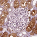 Immunohistochemical staining of human kidney shows moderate to strong cytoplasmic positivity in cells in tubules.