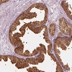 Immunohistochemical staining of human prostate shows moderate to strong cytoplasmic positivity in glandular cells.
