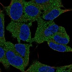 Immunofluorescent staining of human cell line SH-SY5Y shows localization to cytosol.