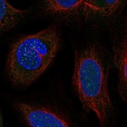 Anti-DSN1 Antibody