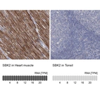Anti-SBK2 Antibody