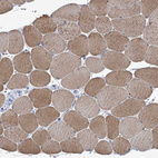 Immunohistochemical staining of human skeletal muscle shows moderate cytoplasmic positivity in myocytes.
