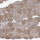 Immunohistochemical staining of human skeletal muscle shows moderate cytoplasmic positivity in myocytes.