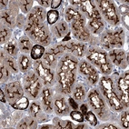 Immunohistochemical staining of human kidney shows strong cytoplasmic and membranous positivity in cells in tubules.