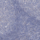 Immunohistochemical staining of human tonsil shows no positivity in non-germinal center cells as expected.