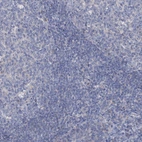 Immunohistochemical staining of human tonsil shows no positivity in non-germinal center cells as expected.
