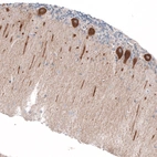 Immunohistochemical staining of human cerebellum shows moderate cytoplasmic positivity in Purkinje cells.