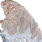 Immunohistochemical staining of human cervix, uterine shows moderate membranous positivity in squamous epithelial cells.