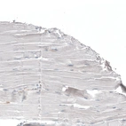Immunohistochemical staining of human skeletal muscle shows no positivity as expected.