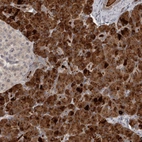 Anti-ZFP14 Antibody