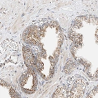 Anti-YIPF7 Antibody