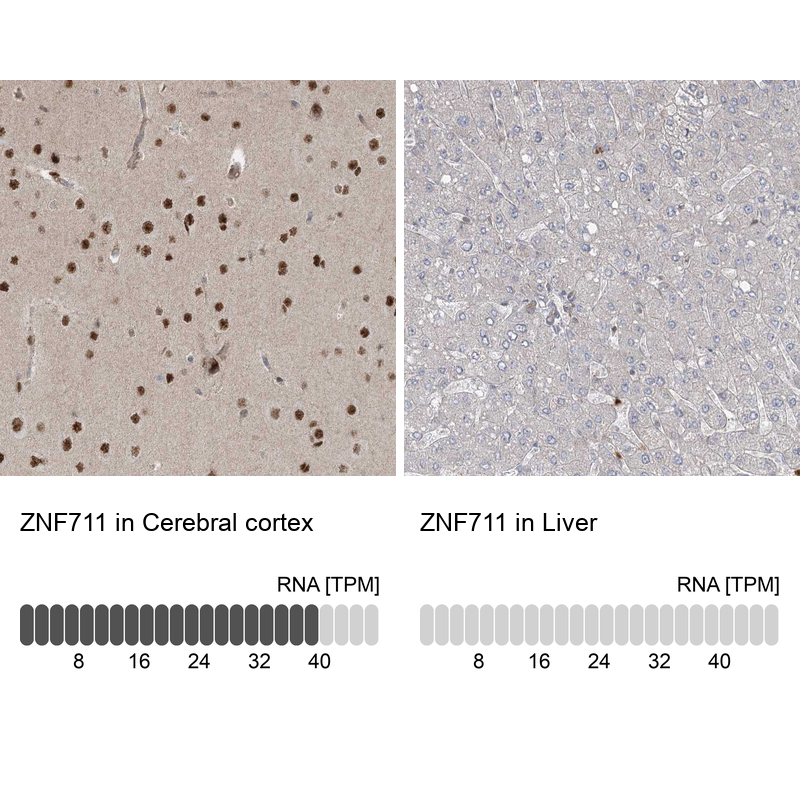 Anti-ZNF711 Antibody