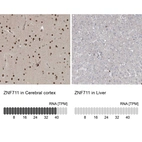 Anti-ZNF711 Antibody