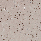 Immunohistochemical staining of human cerebral cortex shows moderate to strong nuclear positivity in neurons.